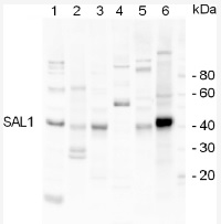 SAL1 | Sal1 phosphatase in the group Antibodies Plant/Algal  / Environmental Stress / Salt stress at Agrisera AB (Antibodies for research) (AS07 256)